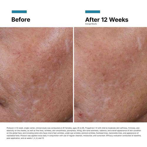 Hyaluronic Acid Intensifier (H.A.)