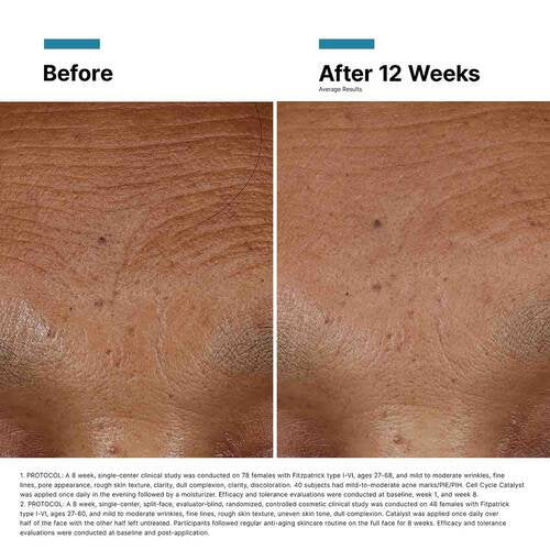 Hyaluronic Acid Intensifier (H.A.)